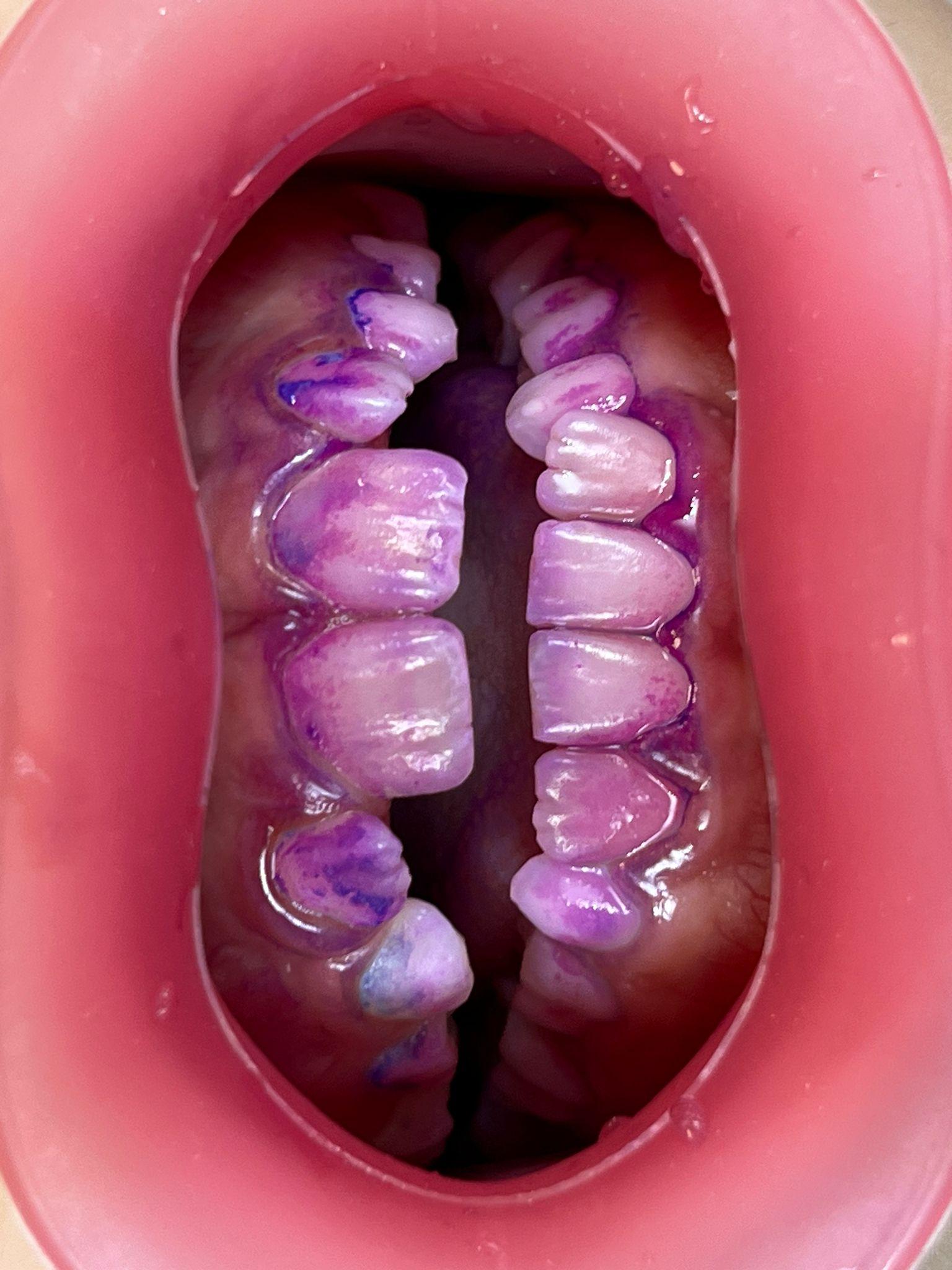 Intraorale Dentalfotografie: ein praktischer Leitfaden für die moderne Praxis