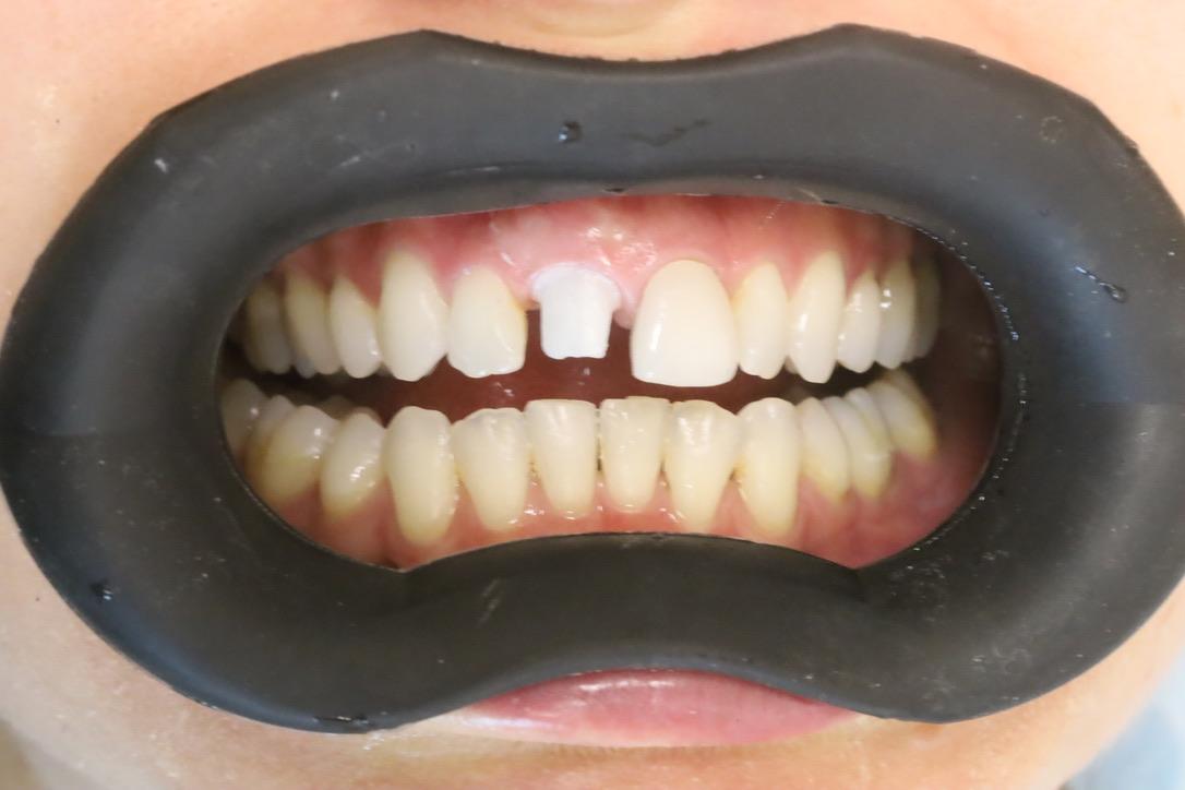 Dentalfotografie mit integriertem Kontraster
